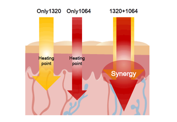 ���޽�����߱� ��ť�������� ���������