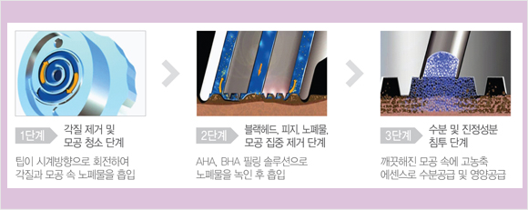 �������ʸ� �ý��� �ܰ�